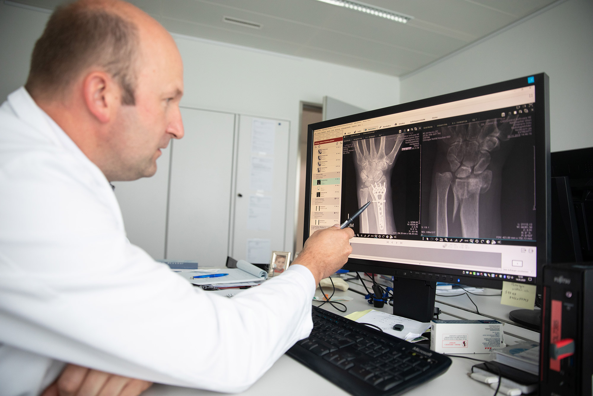 Der Arzt zeigt Röntgenbilder von gebrochenen Knochen